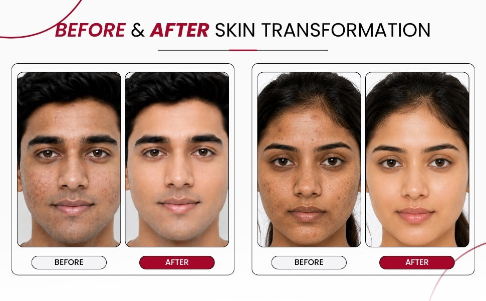 WOODOO Hello, Clear Skin Facewash — before and after